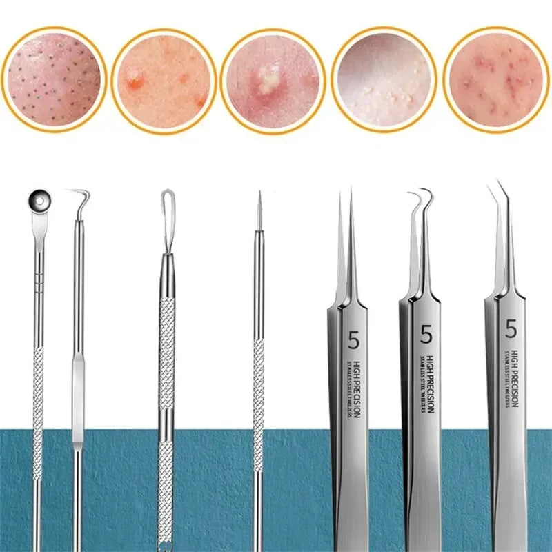 1/11Pcs Blackhead & Acne Remover Tool Set – Tweezers & Extractor Kit