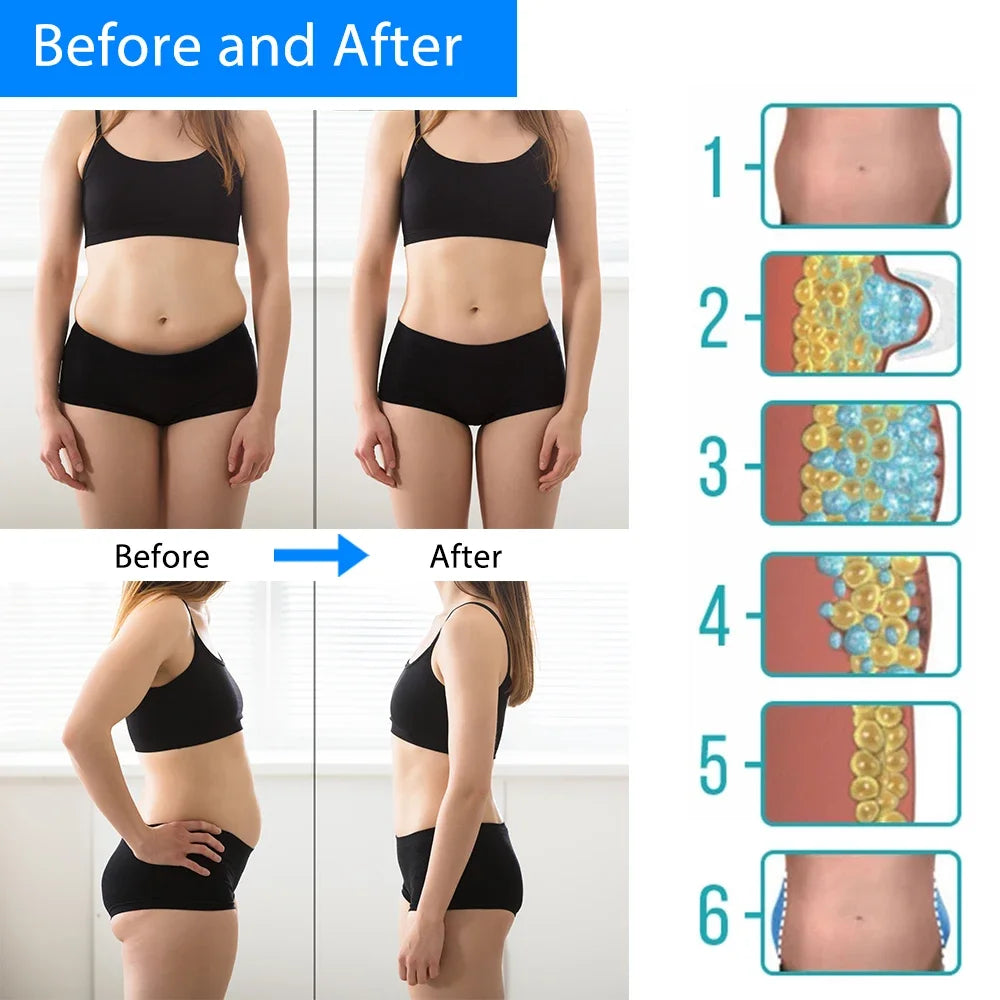 Cryotherapy Fat Freeze & Cellulite Massager