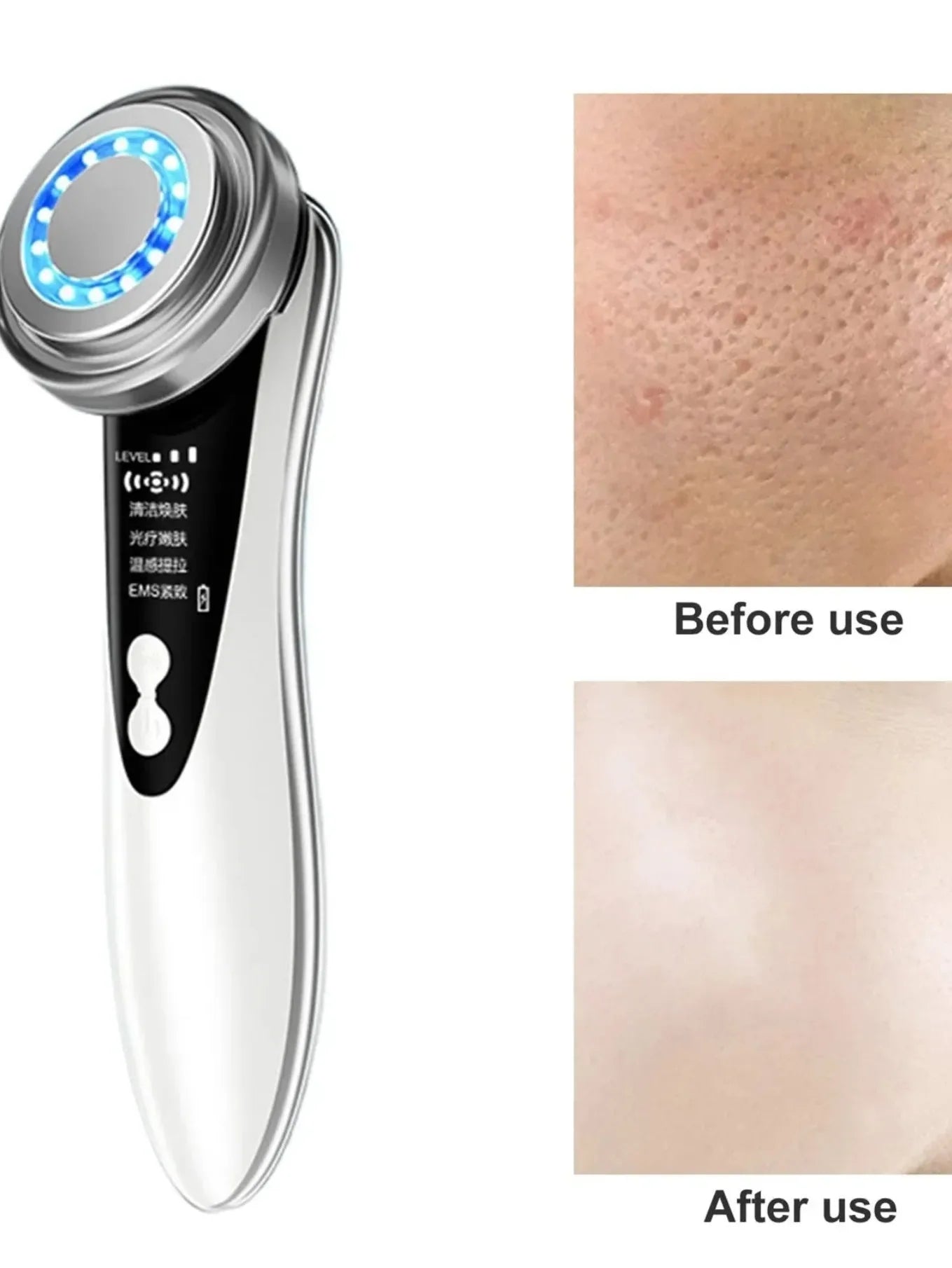 5-in-1 Facial Massager – LED Therapy, Eye Care & Skin Smoothing (USB Rechargeable)