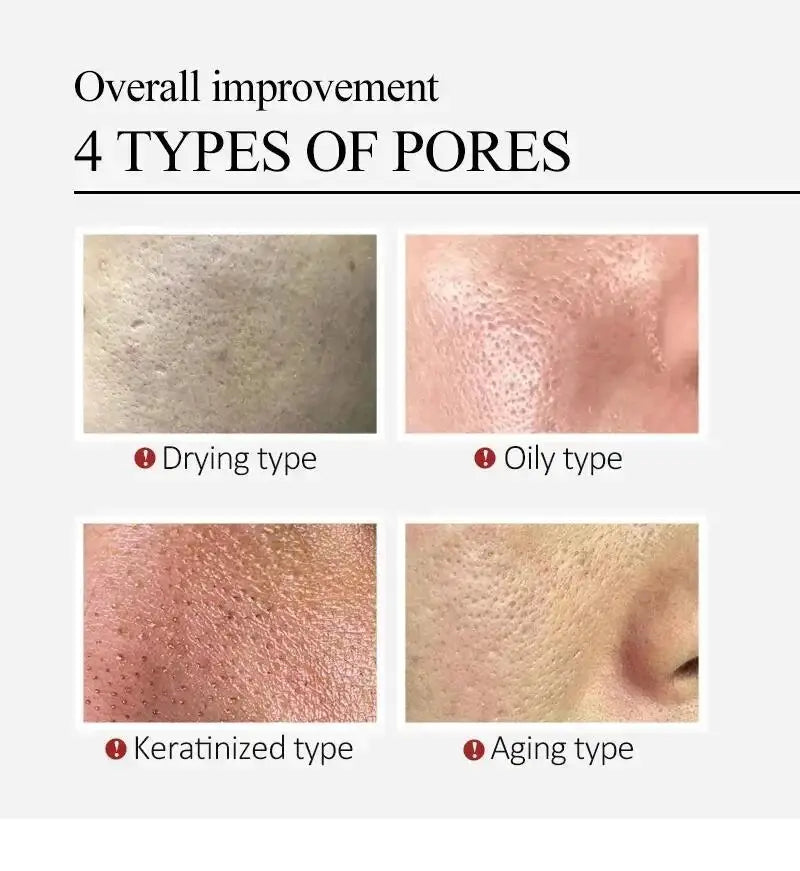 Salicylic Acid Pore Clearing Cream